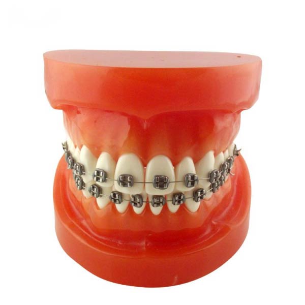 Model Orthodontic UM-B9 (Metal bracketi)