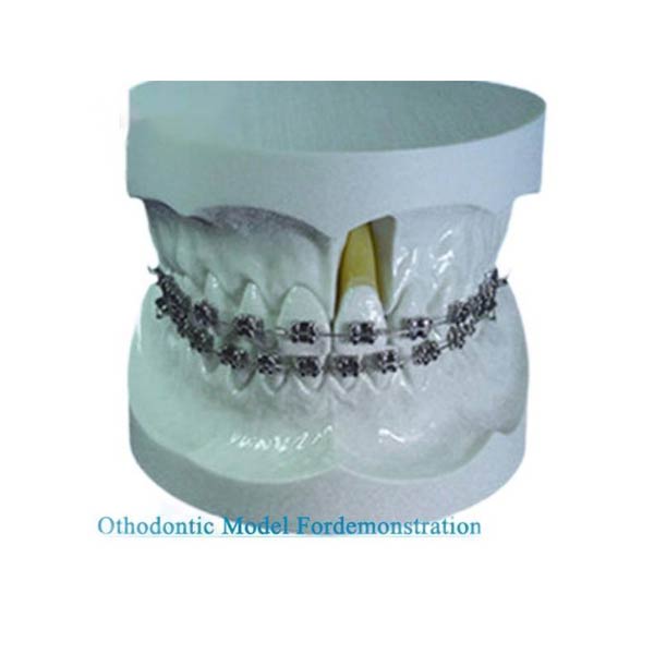 UM-S11 Orthodontic Modelo In Demonstration cum Edgewise Bracketa