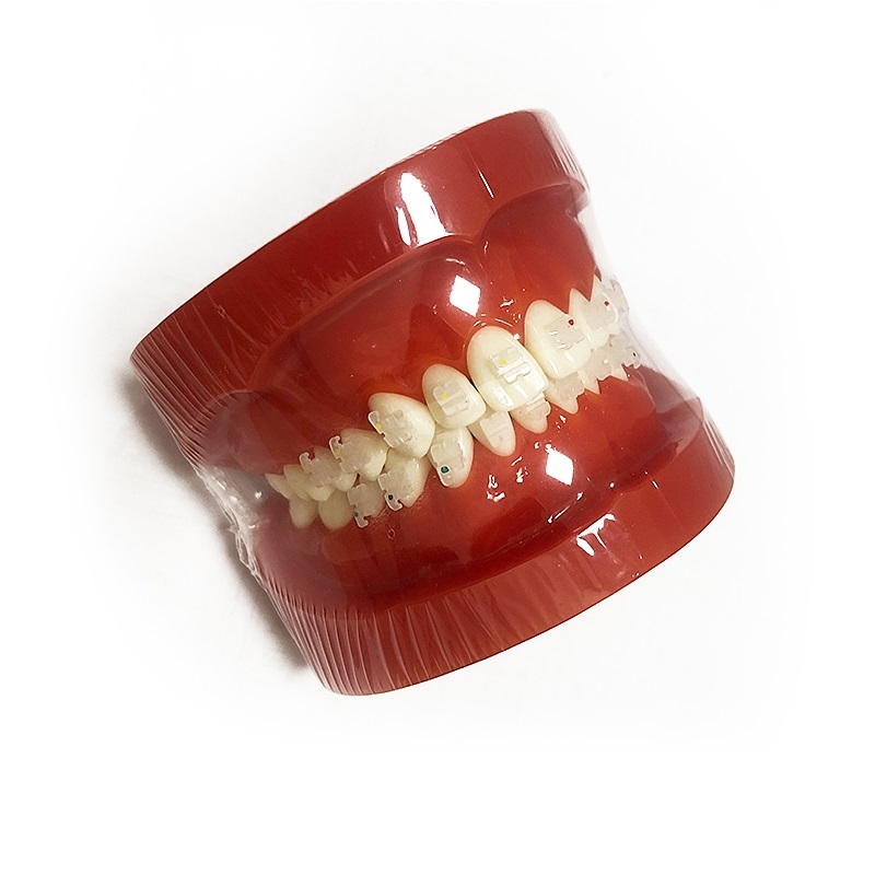 UM-B8 Orthodontic Model (Ceramic bracketi)